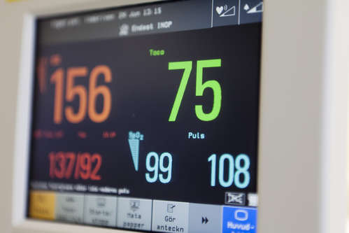 CTG-monitor